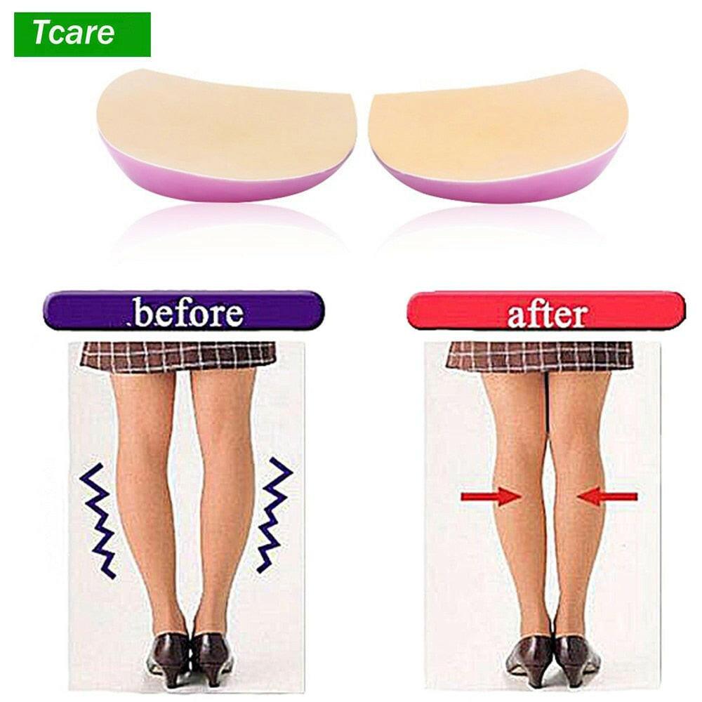 wtf Tcare X/O Legs Orthopedic Shoes Insoles Silicone Gel Arch Support Pad for Women Flat Foot Orthotic Inserts Pain Relief High Heel.