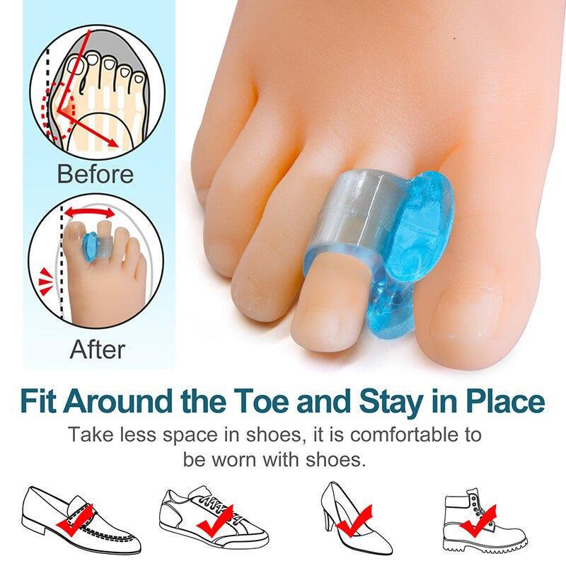 Sumifun blue silicone gel toe separator and bunion spacer, foot care tool for hallux valgus and thumb correction, 1 pair.